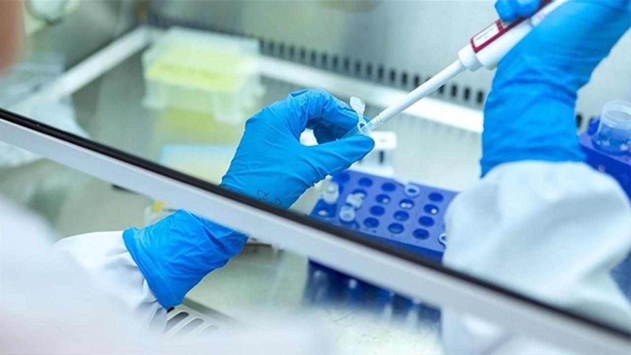 hepatit-laboratuvar-2085096.jpg